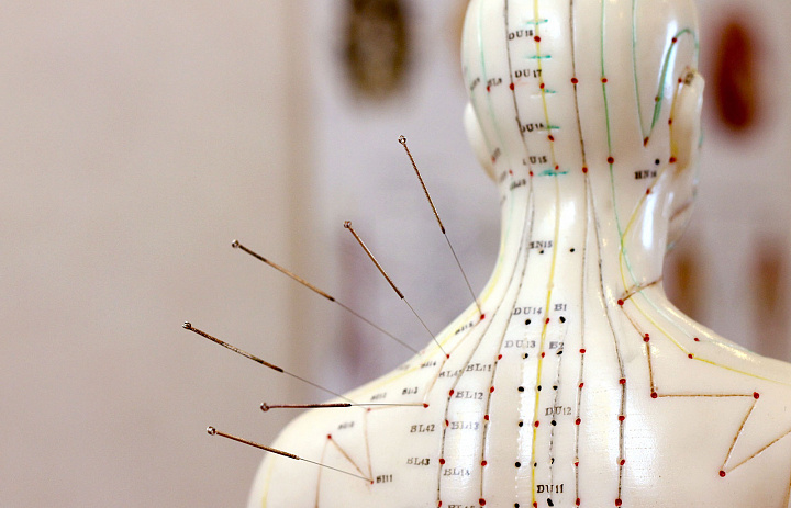 Для постановки игл врач использует пинцет. Сами иглы, как и пинцет, должны быть стерильными. Иглы в аурикулярные точки вводятся под прямым углом, а в корпоральные точки – под углом 10-120. Пациент при этом не испытывает боли, лишь легкое покалывание.