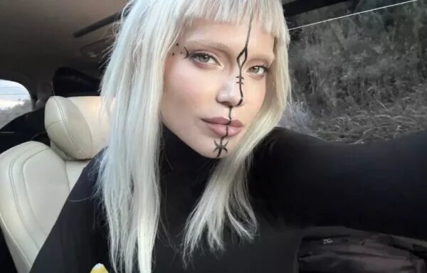    Глюкоза, фото: соцсети