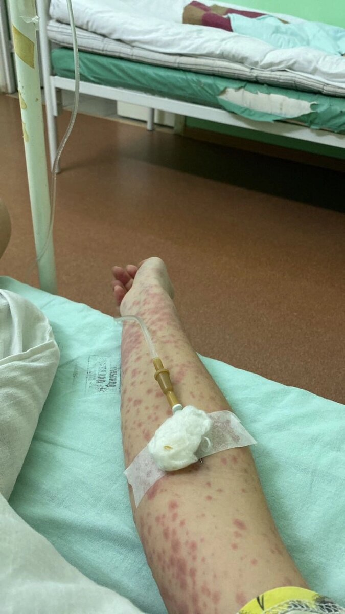    Лечение заняло месяц. Фото: Из личного архивa/ Карина Дубровина