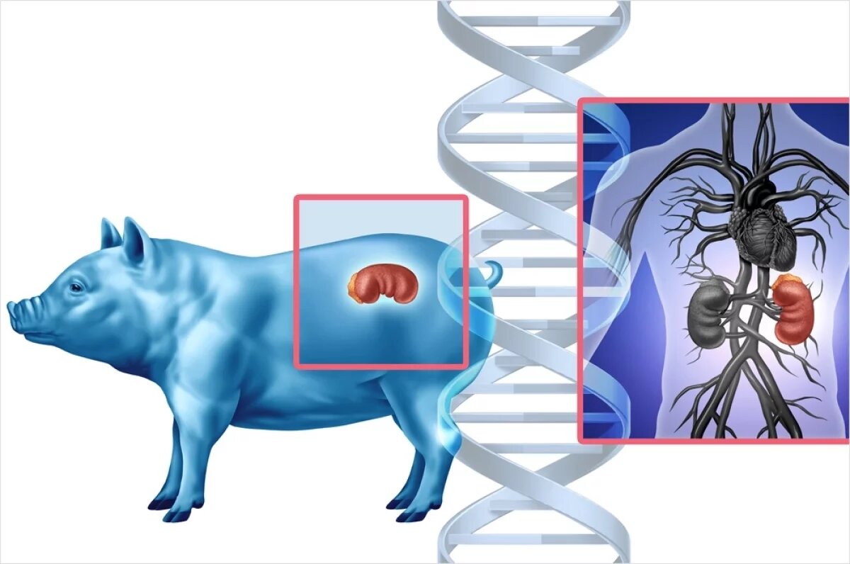   Отторжение и инфекции.