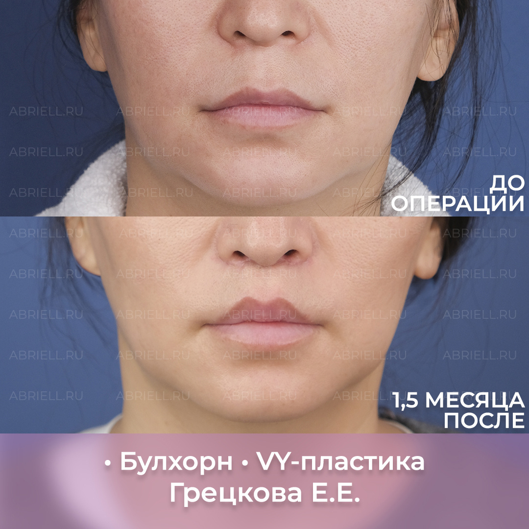 Хирург: Грецкова Е.Е.