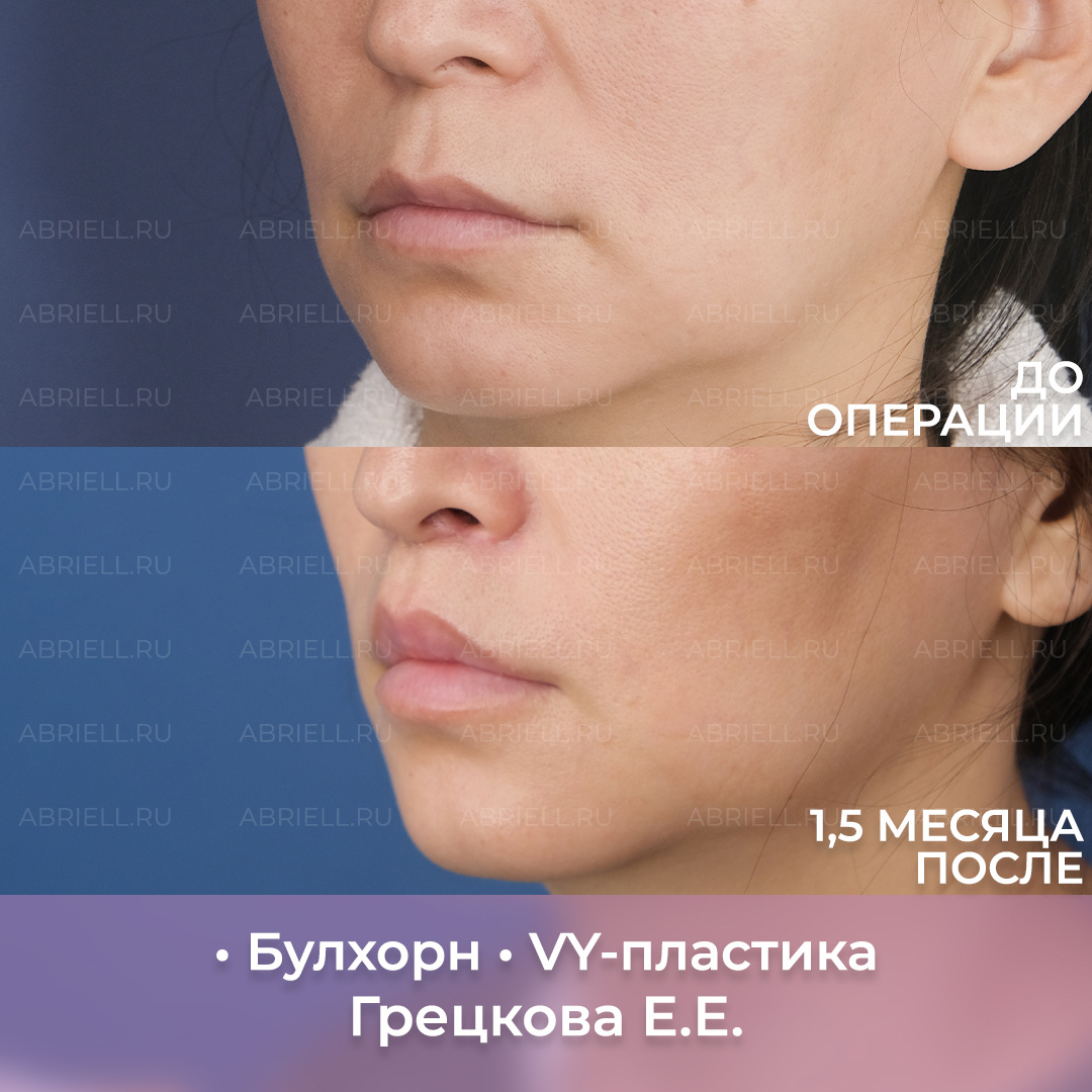 Хирург: Грецкова Е.Е.