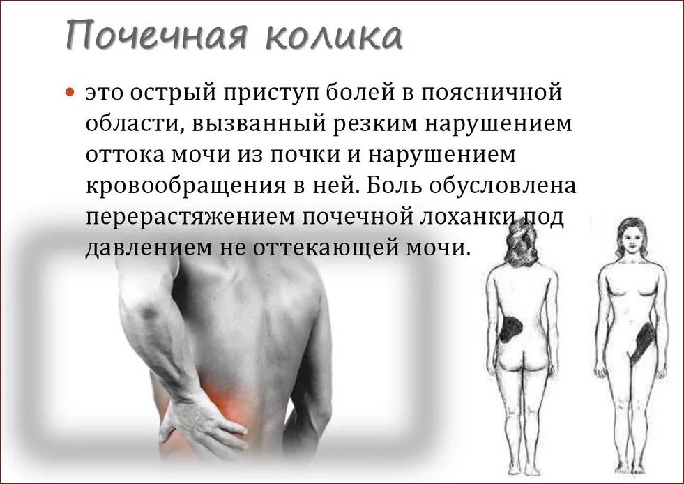 Ноет где почки