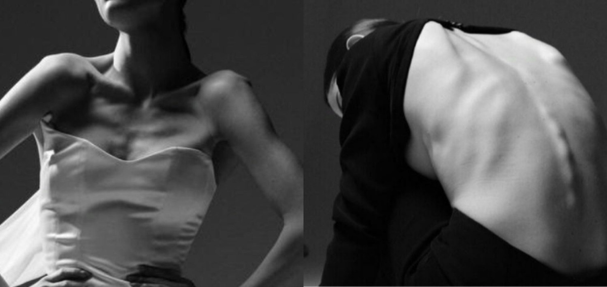 Е. Медведева после приёма Оземпика. Соц. сети фигуристки. 