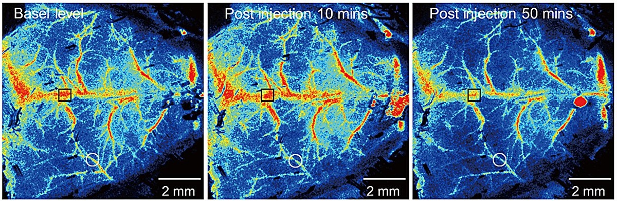 Влияние MPL-клеточных обструкций на мозговое кровообращение через тромбообразование, которое подавляет интрацереброваскулярную перфузию крови. На изображении представлены результаты лазерной спекл-контрастной визуализации (LSCI) в различные моменты времени. Для наглядности выделены две области: чёрный квадрат обозначает зону с высокой перфузией (более 500 единиц перфузии, PU), а белый круг – зону с низкой перфузией (менее 400 PU), что позволяет сравнить участки с нормальным и нарушенным кровотоком.    
 Источник: Science Advances (2025). DOI: 10.1126/sciadv.adr8243  📷
