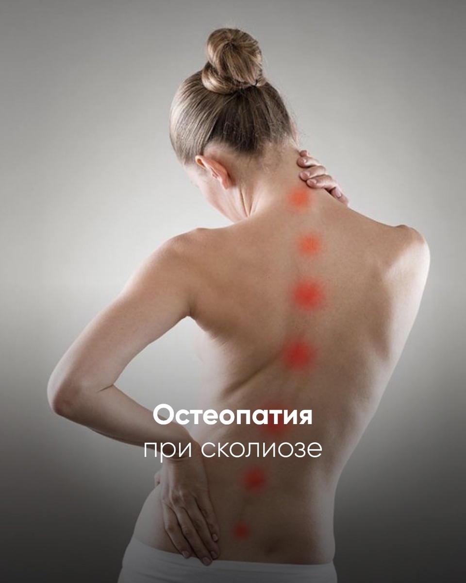 сколиоз