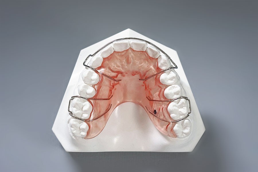 Ретенционная пластинка.