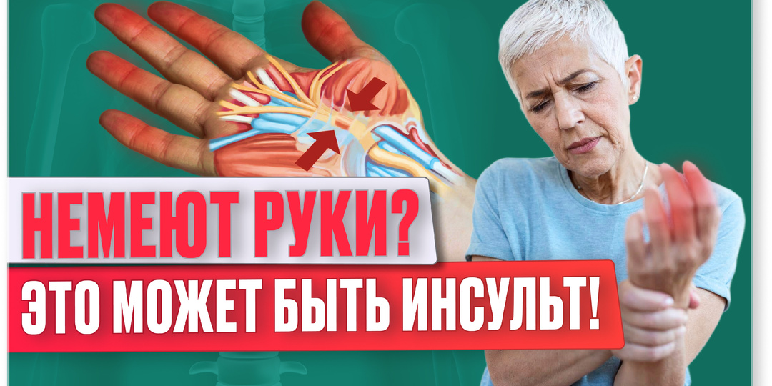 Что делать, если немеют руки и пальцы? Этот симптом ОПАСЕН для жизни!