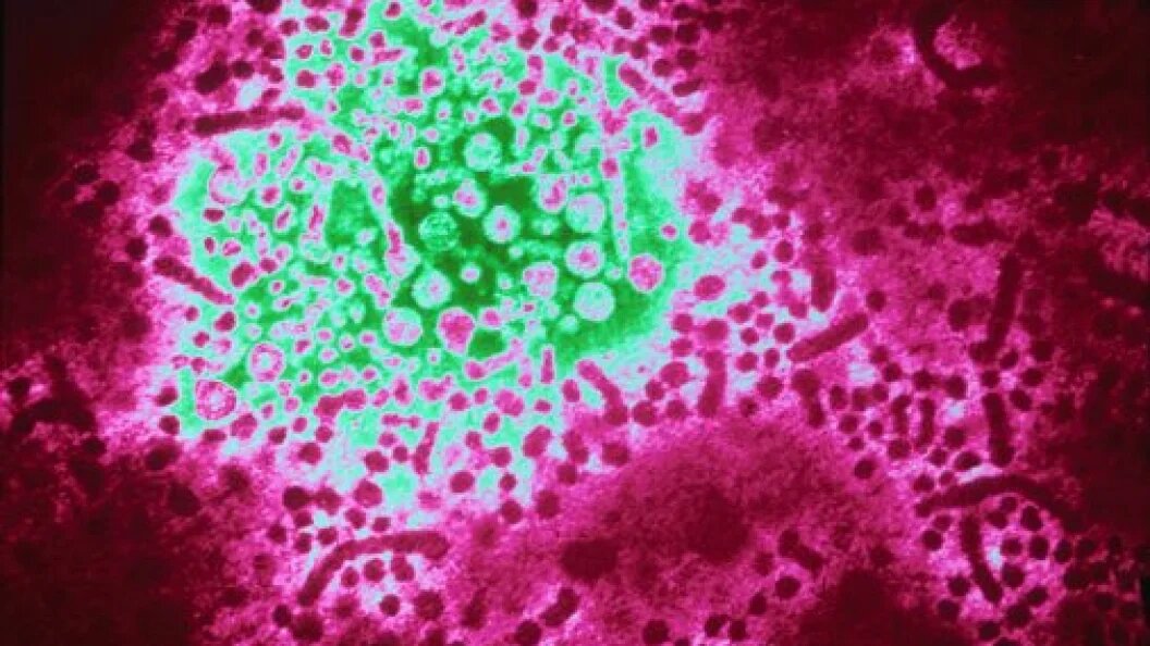    Фото: Custom Medical Stock Photo/Globallookpress