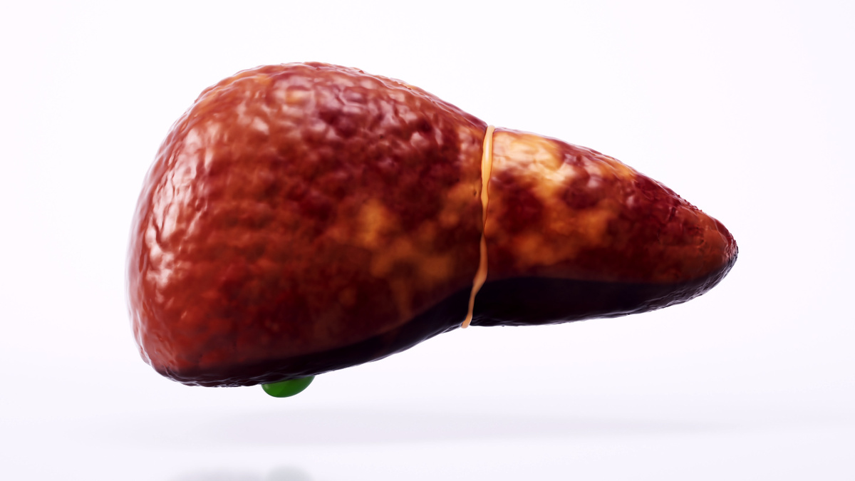 Жировая болезнь печени - такая печень не хорошо!