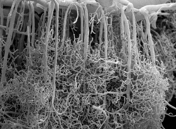 Надо ли гипертоникам принимать "кроверазжижающие" препараты? Лишь некоторым