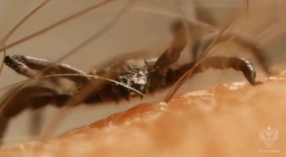    Фото: Пресс-служба Роспотребнадзора/ скриншот видео