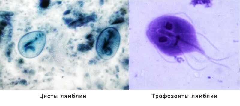 Грушевидная форма трофозоита помогает лучше прикрепляться к стенке кишечника и осуществлять передвижение по ней с помощью жгутиков