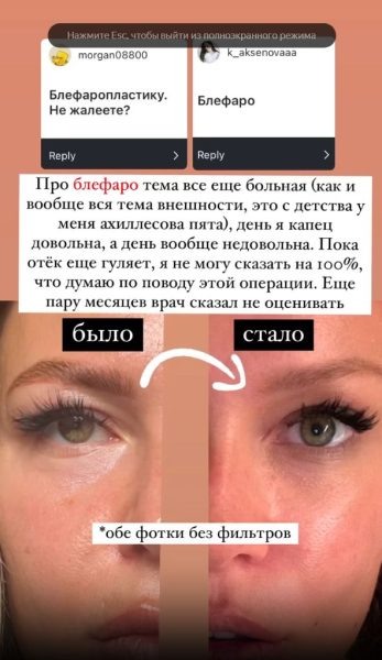    Рита Дакота, фото: соцсети