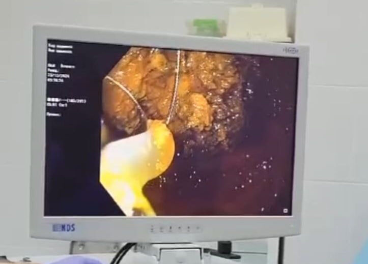 © Фото - минздрав НСО.📷
