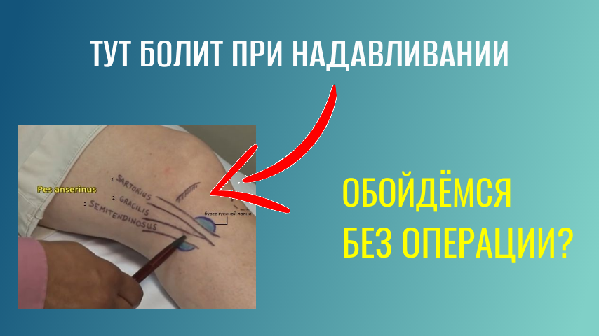 Боль во внутренней части коленного сустава 