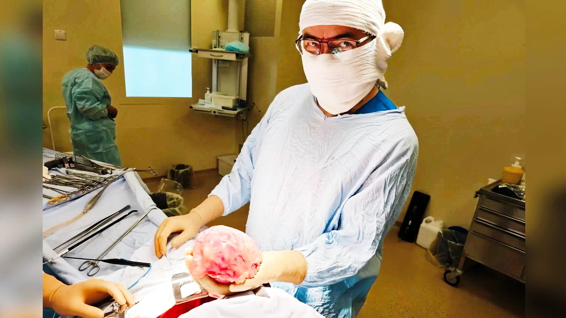    Югорчанину удалили большую опухоль рядом с сердцем