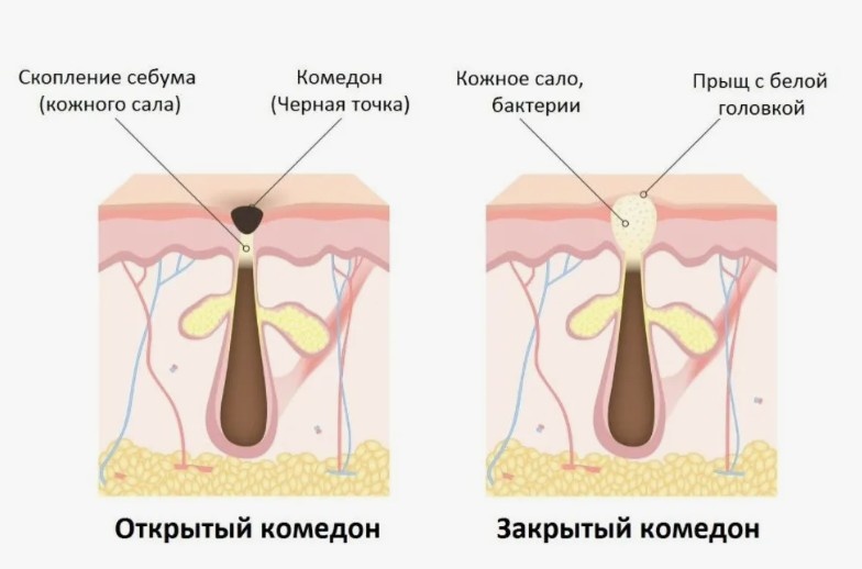 Специально для чувствительных людей в статье будут только схематичные картинки или с размытием / guru.wildberries.ru