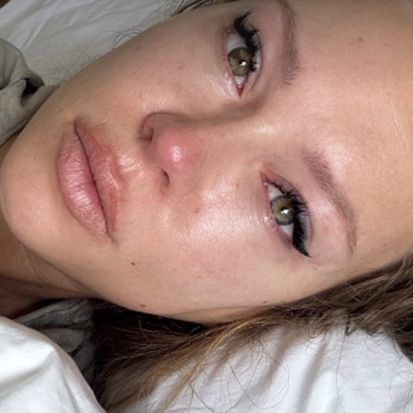     Рита Дакота не может восстановиться после пластической операции