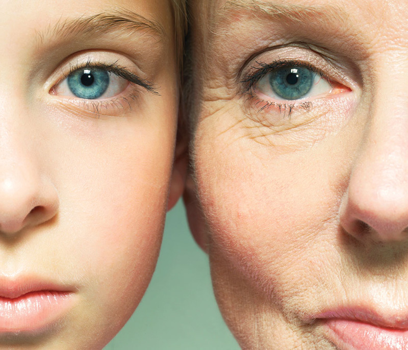 Старение глаз