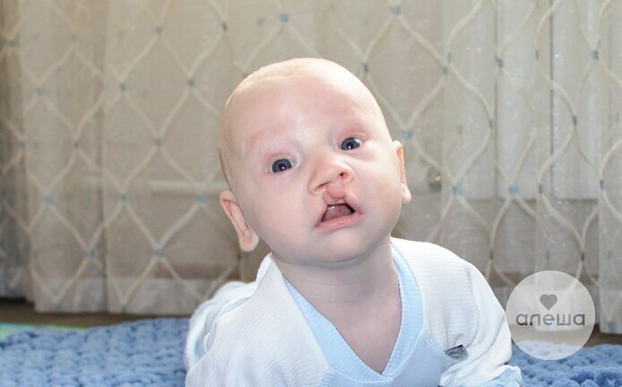 Миша Познер, подопечный фонда «Алёша»