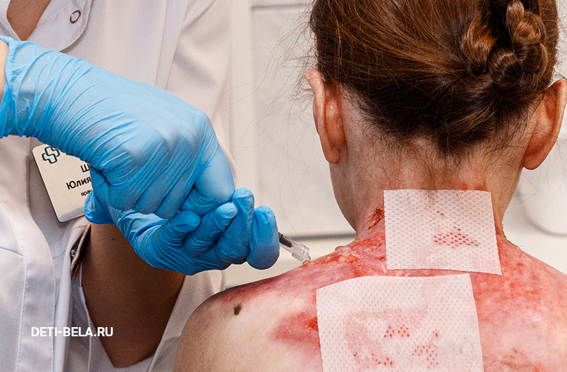 Процесс нанесения препарата подопечной Оле