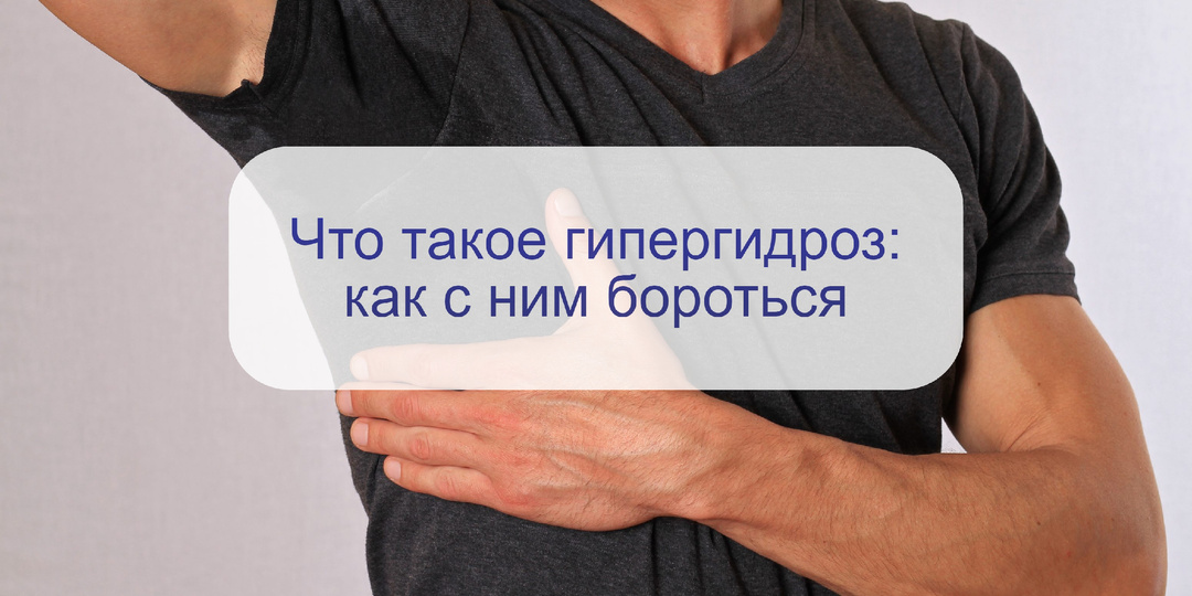 Гипергидроз – не просто потливость: мокрая одежда, запах пота и проблемы со здоровьем – но откуда?