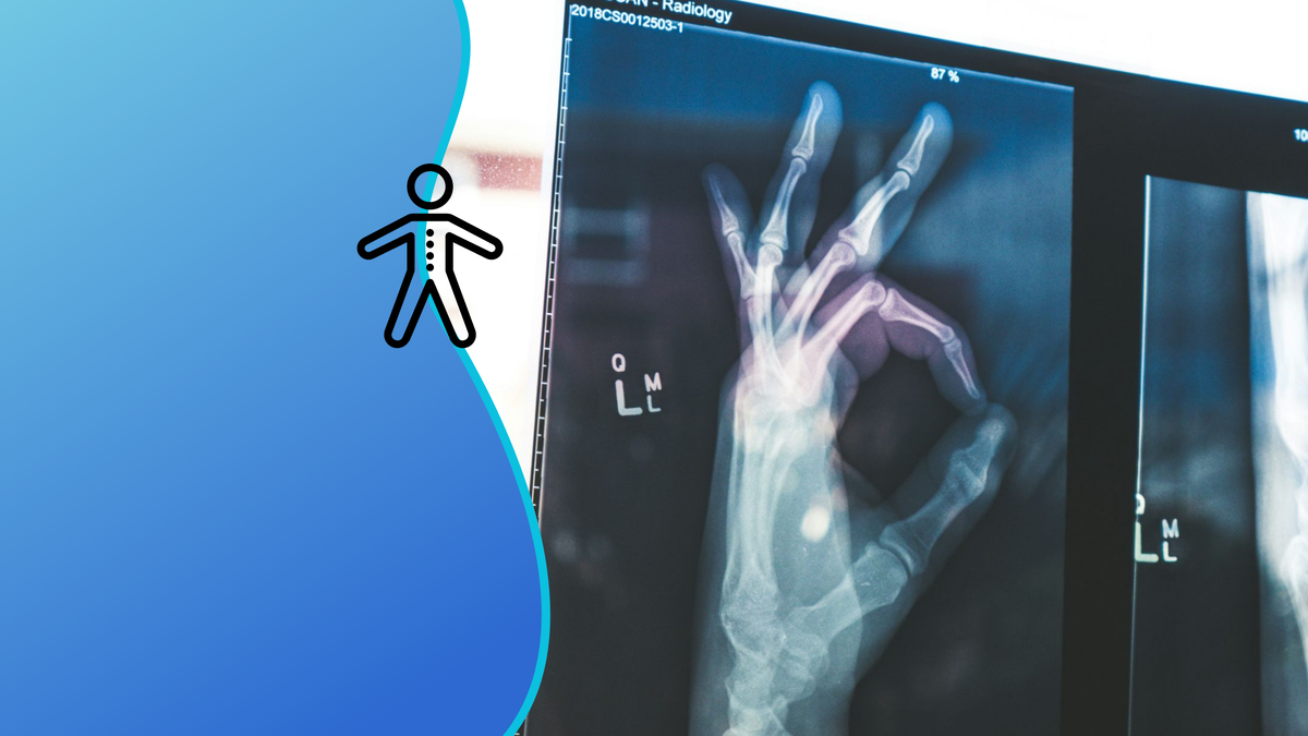 Новый сплав можно применять не только в медицине, но и в других сферах. Коллаж: медиацентр УрФУ.