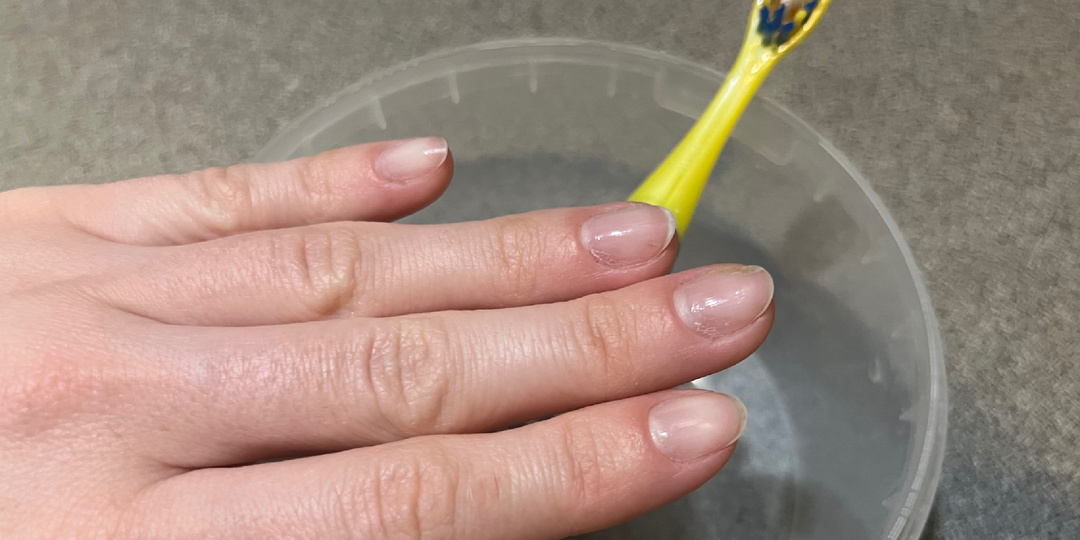 Прекратите игнорировать диабет: 9 внешних признаков, которые указывают на повышенный сахар