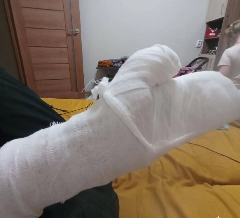    Марине наложили гипс. Фото:  ГУ МЧС России по Ростовской области