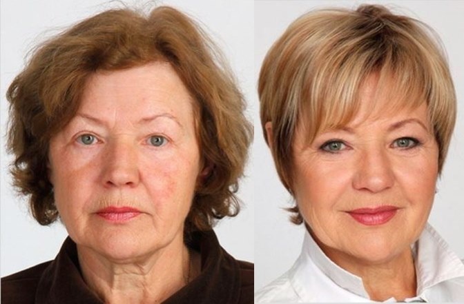 Как помолодеть без особых усилий: ДО и ПОСЛЕ — а вы так можете?