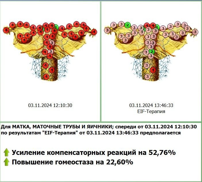 Результаты диагностики в программе Дианел