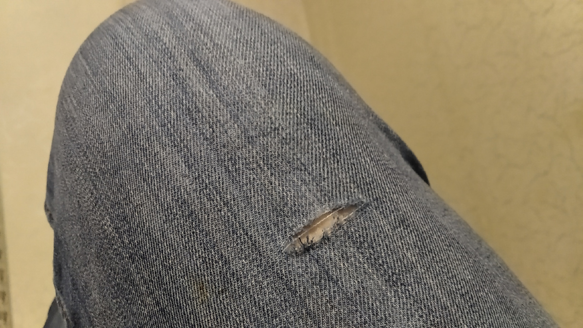 Это моя коленка