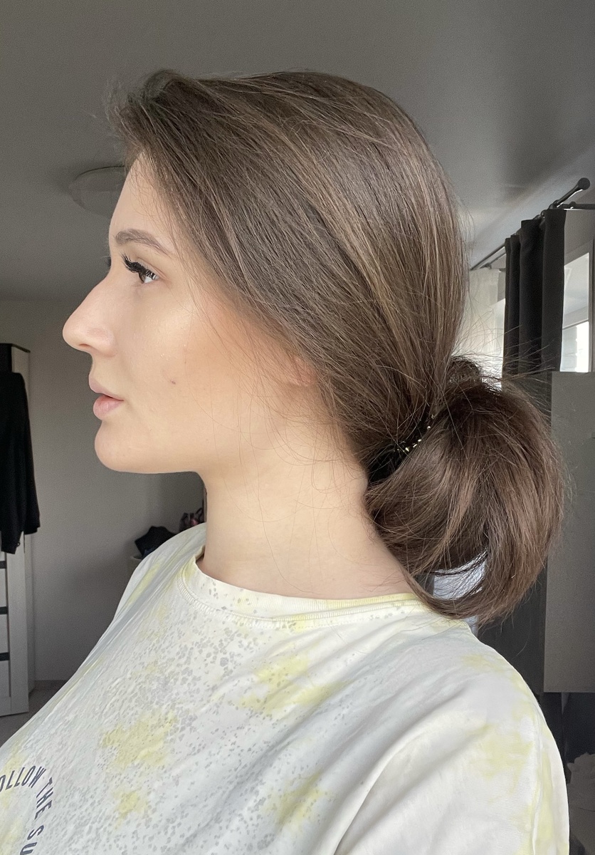 Вот так выглядело мое лицо ДО