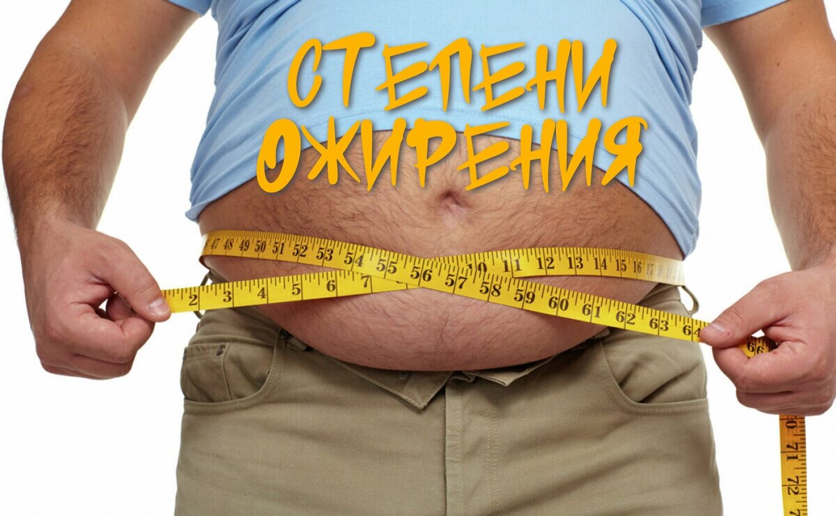 Степени и типы ожирения