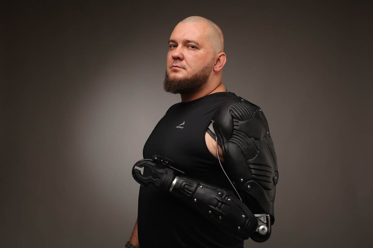 Виктор с новым спортивным протезом