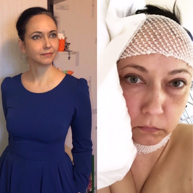 Между фото 2 месяца. Зима 2018-2019.