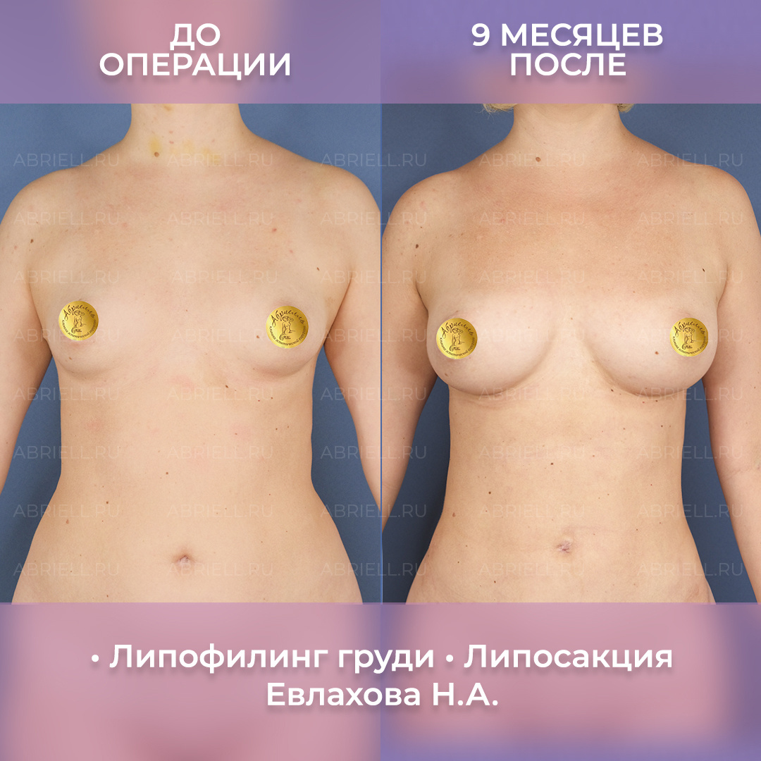 Хирург: Евлахова Н.А.