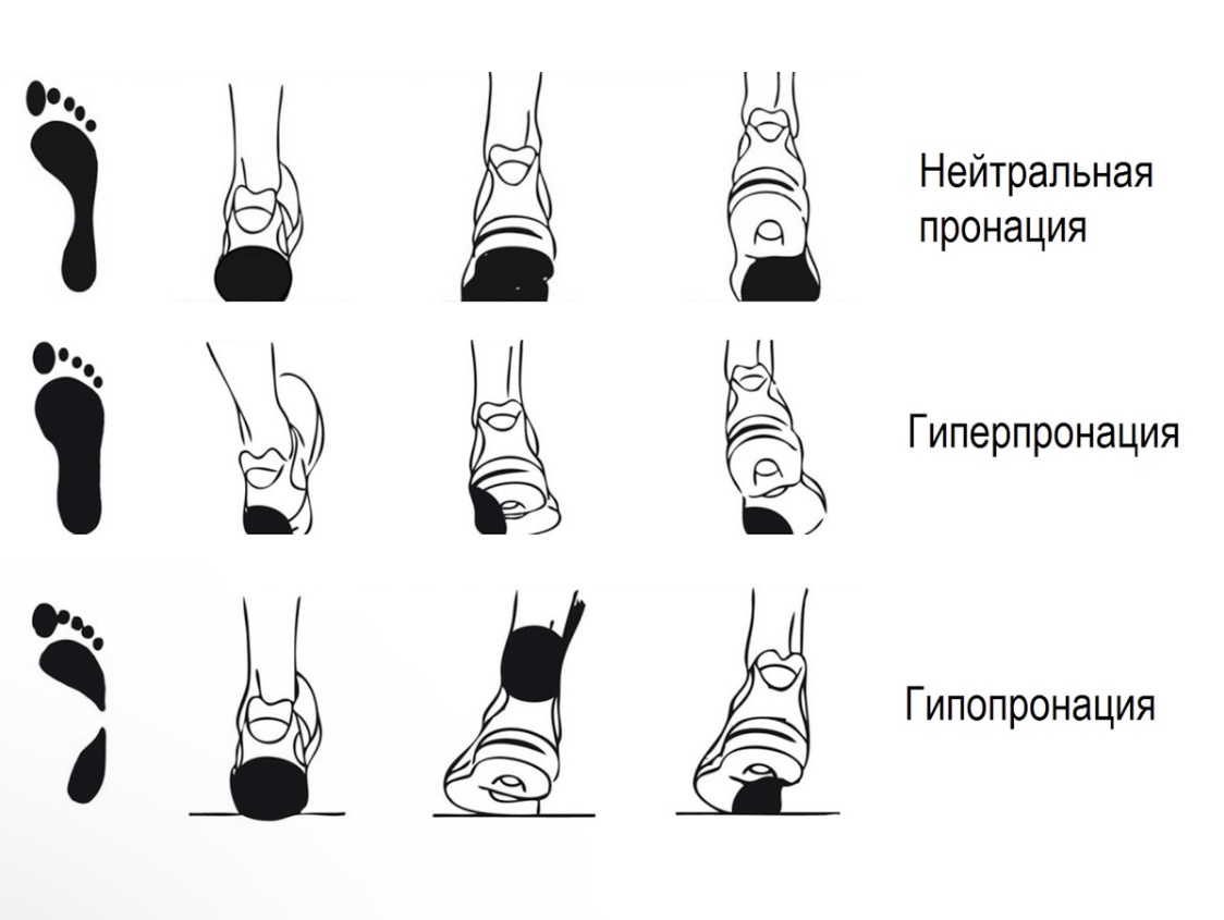 Типы пронаций