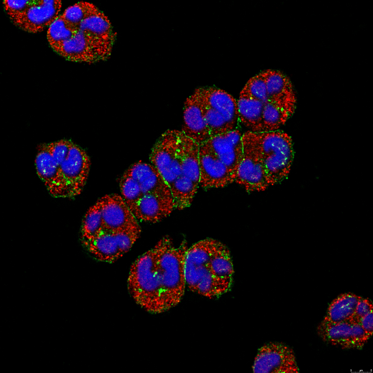 Нейтрофилы человека при конфокальной микроскопии.  Изображение взято с сайта. https://www.niams.nih.gov/niams-multimedia-library/search/human-neutrophil-image-2
