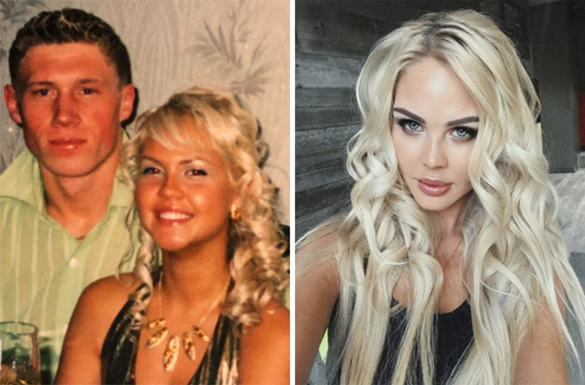 Мария до пластики и после