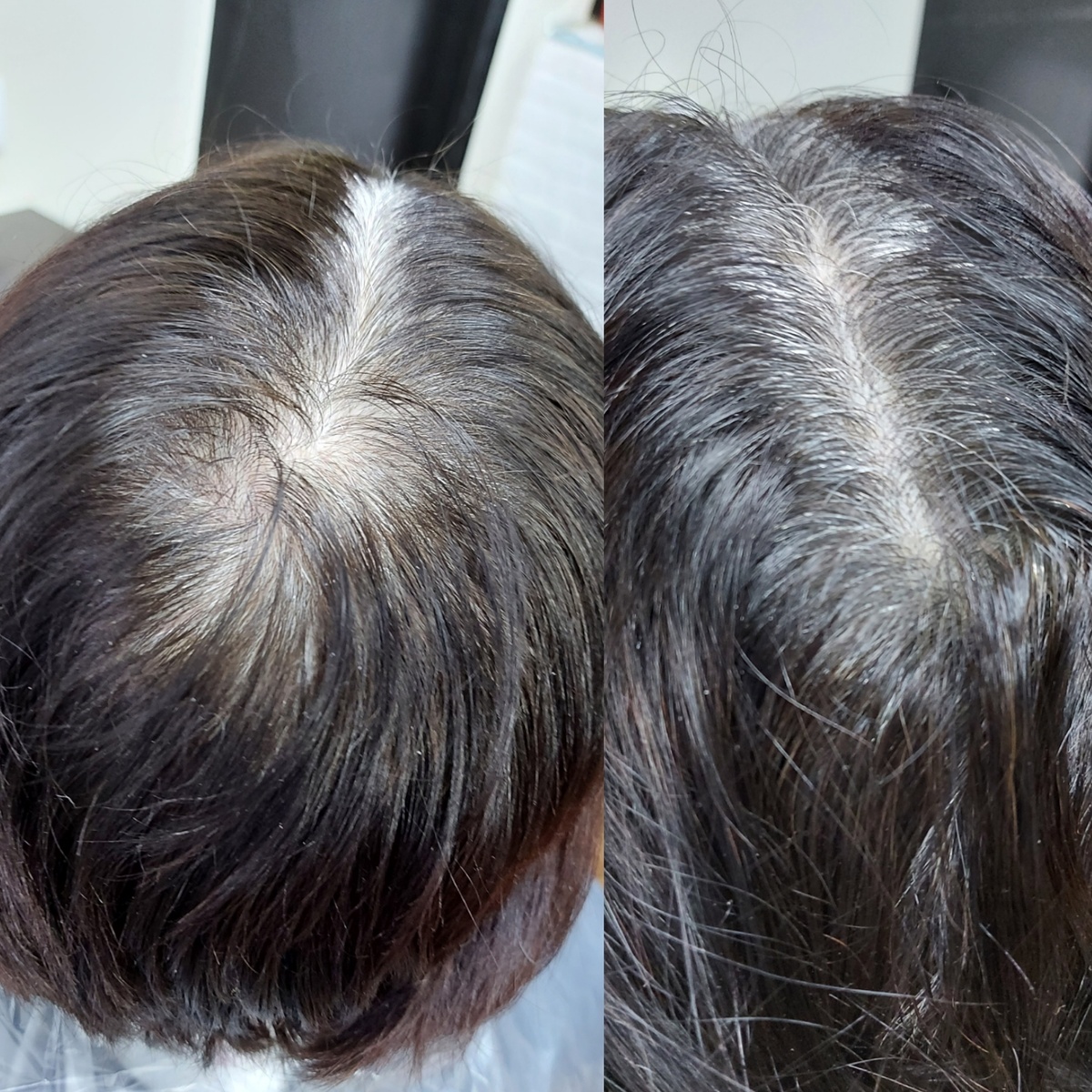 Варианты "до" из моей практики. 