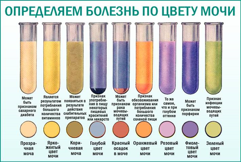 Настоятельно рекомендуем при любом изменении цвета мочи обращаться к врачу и не заниматься самолечением.