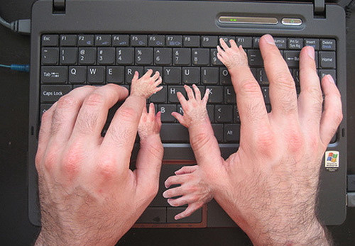 Мои руки устроены по ходу так же... Фото из открытых источников сети Интернет 