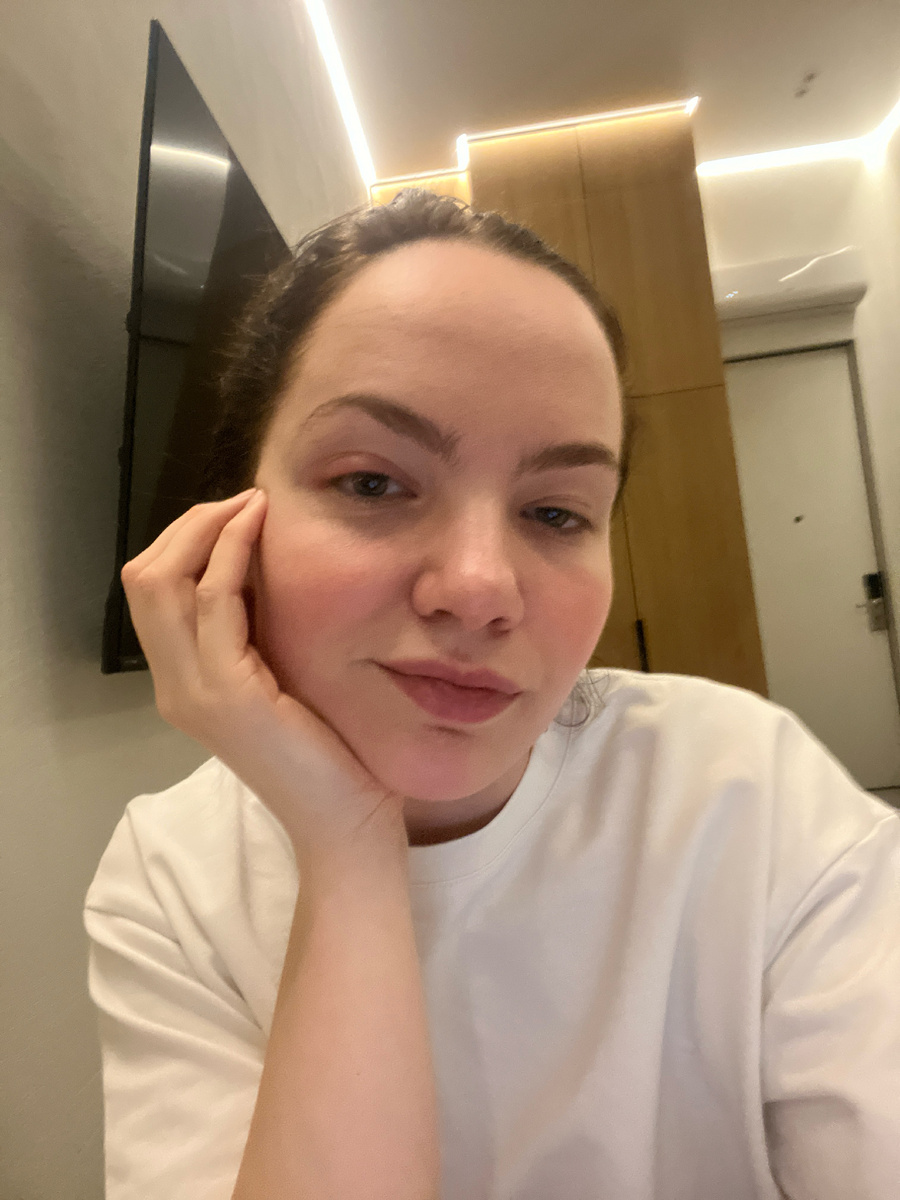 Вот такой шикарный халязион 