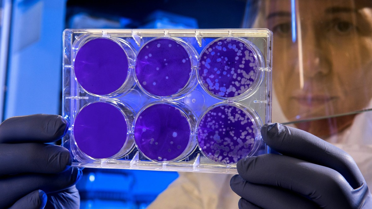    Резистентность к антибиотикам угрожает человечеству. Но беду можно остановить. Фото: unsplash