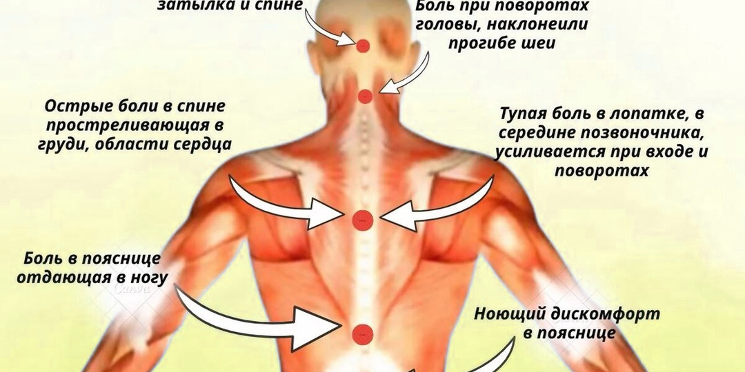 Карта боли: что означает боль в разных частях спины?