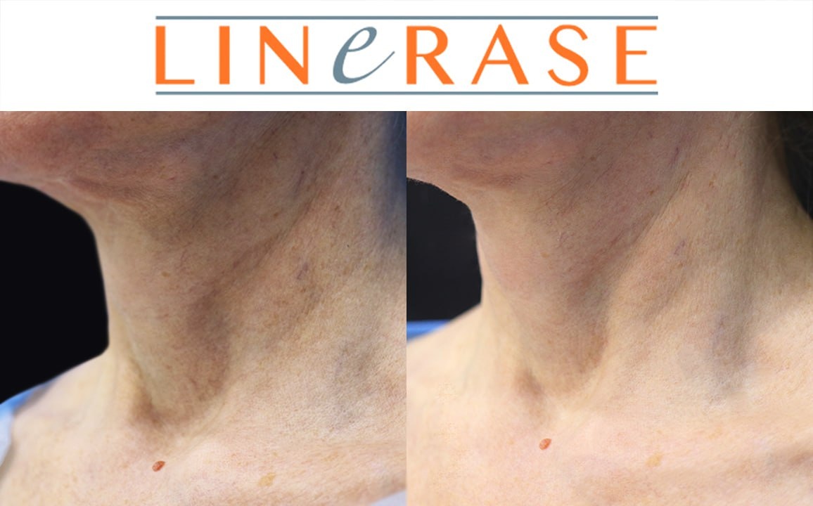 Листайте галерею