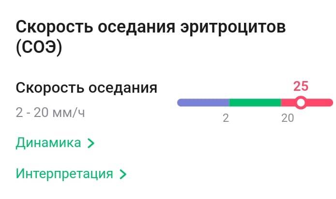 СОЭ повышен, но не в два раза