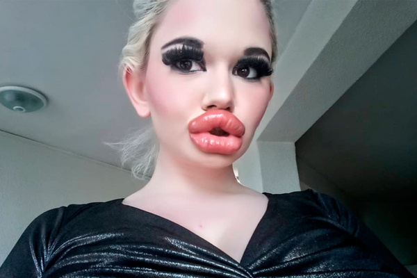 Одни из самых больших губ в мире:)